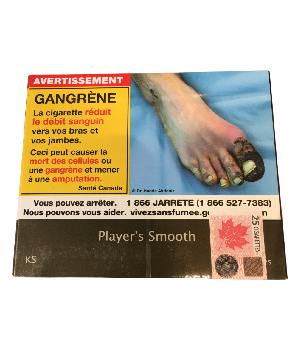 does smoking cigarettes cause lung cancer Cancers linked to tobacco use make up 40% of all cancers diagnosed in the United States | CDC Online Newsroom does smoking cigarettes cause lung cancer Cancers linked to tobacco use make up 40% of all cancers diagnosed in the United States | CDC Online Newsroom